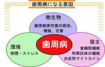 歯周病になる要因